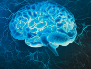 EKT - effektiv, aber immer noch stigmatisiert