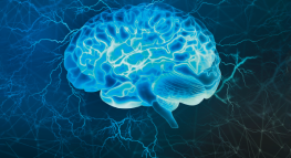Elektrokrampftherapie - effektiv, aber immer nocht stigmatisiert