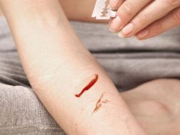 AtR!Sk-Neues Ambulatorium für Risikoverhalten und Selbstschädigung bei Jugendlichen